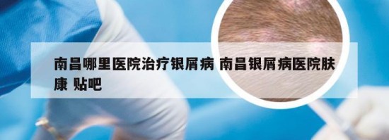 南昌哪里醫(yī)院治療銀屑病 南昌銀屑病醫(yī)院膚康 貼吧